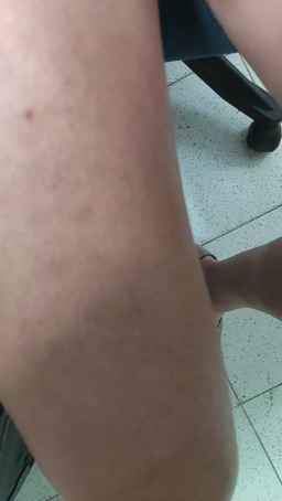 LadyScarlettxk Webcam Rips 15-06-2023